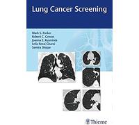 Lung Cancer Screening