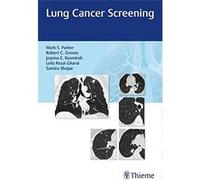 Lung Cancer Screening Mark Parker (Auteur)