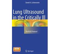 Lung Ultrasound in the Critically Ill: The Blue Protocol