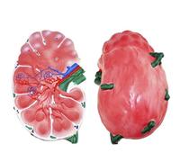 Lymph Node Enlargement Model, Human Lymph Node Anatomical Model with Key Anatomical Features, Clear Texture and Durable No Deformation Material, for Schools, Hospital, Clinic, Laboratory