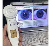 LZDOYY Caméra Portable d'iridologie d'ordinateur USB de 5,0 MP, caméra d'ordinateur d'iridologie d'analyseur d'ordinateur, 30X