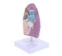 MAGICLULU Modèle de Poumon Pathologique Anatomique Respiratoire Éducatif pour Étudiants et