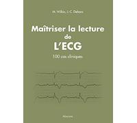 Maitriser la lecture de l'ecg: 100 CAS CLINIQUES
