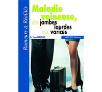 Maladie veineuse, des jambes lourdes aux varices : Rumeurs & Réalités
