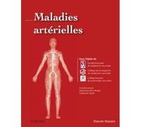 Maladies artérielles Société Française de Médecine Vasculaire (Auteur), Collège des enseignants de médecine vasc (Auteur), Professeur Alessandra Bura-Rivière (Auteur), Guillaume Mahé (Auteur)