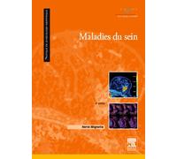 Maladies du sein
