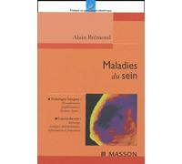 Maladies du sein
