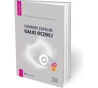Maladies inflammatoires du globe oculaire - Guide du praticien - Leitfaden für den praktischen Arzt (Medizin auf Polnisch)