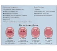 Mallampati Score Airway Evaluation Clinical Reference Poster Wall Art for Clinic Education Nursing Students