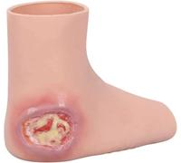 Manchon portable en silicone for ulcères de pression au talon | Simulateur de plaies de décubitus étape 3, modèle réaliste de plaie du pied for la pratique et la démonstration