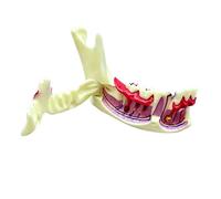 Mandibule anatomique et gingival avec pièces de Pingiva ouvertes Aide pédagogique pour démonstration en salle de ucation clinique Mandibule Exemple