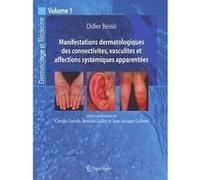 Manifestations dermatologiques des connectivites, vasculites et affections systémiques apparentées Didier Bessis (Auteur), Jean-Jacques Guilhou (Auteur), Bernard Guillot (Auteur), Camille Frances (Aut