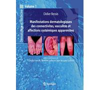 Manifestations dermatologiques des connectivites, vasculites et affections systémiques apparentées: Vol. 1