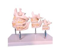 Maquette d'anatomie buccale - 4 étapes de développement dentaire et de la mâchoire pour la formation médicale dentaire, l'éducation