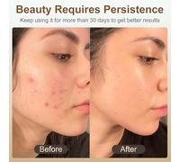 Masque Led Visage en 7 Couleurs, Led Mask Rechargeable,Luminosité Réglable,Masque Facial LED pour la maison et les voyages