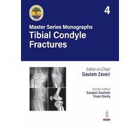 Master Series Monographs: Tibial Condyle Fractures: Volume 4