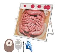 MedEduQuest - Kit de modèle de stomie pour enseignement, éducation et orientation du patient à suspendre et à poser
