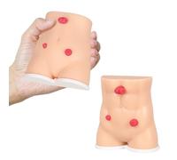 MedEduQuest Lot de 2 modèles de démonstration de stomie en silicone pour l'enseignement médical et l'éducation des patients