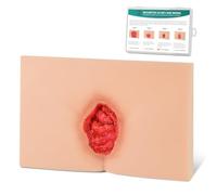MedEduQuest Modèle de soins de l'ulcère décubital, modèle d'escarres, modèle de blessure de pression pour la pratique médicale, étape 3