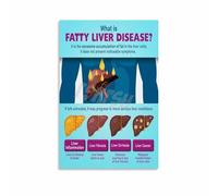 Medical Education Poster: The Liver - Anatomy and Function Chart, Informative Wall Art for Hospital, School, or Nutritionist Office(Framed,08x12inch(20x30cm))