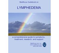 Medifocus Guidebook on: Lymphedema: A comprehensive guide to symptoms, treatment, research, and support