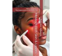 Melanin-Rich Skin & Lasers: “How to Avoid Burns, Hyperpigmentation & Get Perfect Skin"