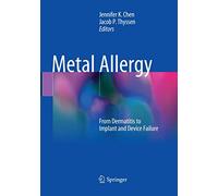 Metal Allergy: From Dermatitis to Implant and Device Failure