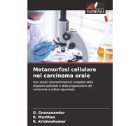 Metamorfosi cellulare nel carcinoma orale: Uno studio istomorfometrico completo della displasia epiteliale e della progressione del carcinoma a cellule squamose