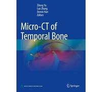 Micro-Ct Of Temporal Bone
