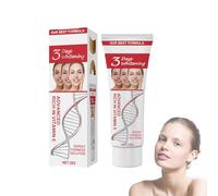 Mikabila (06, F) Crème éclaircissante aux taches de rousseur, Whitening Creme, Spot-Off Freckle Whitening Cream,Crème anti-taches de Rousseur,Crème de traitement pour l'élimination des cicatrices 25g