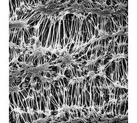 MILLIPORE 053805 Filtre membrane Omnipore porosité 5 µm (Pack de 25)