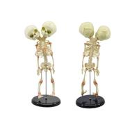 Mini modèle de squelette humain 15 "avec crâne jumeau joint, squelette anatomique du fœtus infantile, 1 pièces