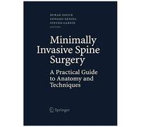 Minimally Invasive Spine Surgery