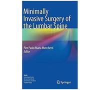 Minimally Invasive Surgery Of The Lumbar Spine
