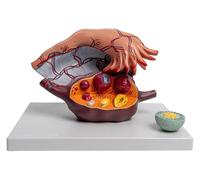 Modèle agrandi 5X de structure de l'utérus et de l'ovaire féminins, modèle d'anatomie utérine humaine amovible, modèle d'anatomie de médecine gynécologique 3 amovible, for la formation