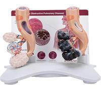 Modèle alvéolaire humain, modèle de comparaison entre alvéoles pathologiques et alvéoles saines, modèle de structure alvéolaire élargie, à des fins de démonstration pédagogique et clinique.