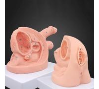 Modèle anatomique de cathétérisme urinaire pour l'entraînement infirmier, maîtrise des techniques de cathétérisme avec marqueurs anatomiques