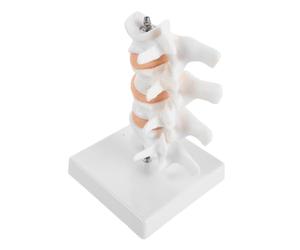 Modèle Anatomique de Colonne Lombaire en PVC Réaliste avec Ostéoporose | Accessoire Pédagogique Portable, Utilisation en Centre de Rééducation, Adapté aux Enseignants en Gériatrie et Étudiants