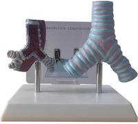 Modèle anatomique de comparaison des bronches saines et du fumeur | Modèle d'enseignement pathologique de la bronchite respiratoire humaine for l'enseignement en n laboratoire