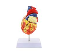 Modèle anatomique de cœur humain agrandi (2X), modèle d'enseignement cardiologie détachable en 4 parties avec base montage, médical