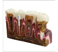 Modèle anatomique de dents à section transversale - Représentation détaillée des dents, des gencives et des racines dentaires pour la formation et la recherche dentaires