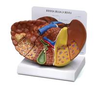 Modèle Anatomique de Foie Humain avec Sections colorées séparées, Outil d'enseignement médical détaillé pour l'éducation, Les démonstrations et la Recherche