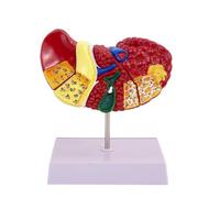 Modèle anatomique de foie humain,modèle éducatif de pathologie de cirrhose | Détachable, texture claire et caractéristiques pathologiques, for l'affichage de la recherche