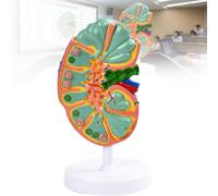 Modèle anatomique de ganglion lymphatique agrandi - Guide d'étude détachable de la structure immunitaire du système lymphatique humain, pour salles de e lycée laboratoires scientifiques