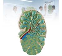 Modèle Anatomique de Ganglion Lymphatique Agrandi, Structure Détachable du Système Lymphatique, Démonstration de Biologie 3D pour Lycée e Médecine & Labo