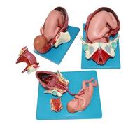 Modèle Anatomique De Laccouchement, Kit De Démonstration De Laccouchement Pelvien, Modèle En Pvc En 3 Étapes Représentant Le Bassin Maternel Et Le Fœtus, Avec Cordon Ombilical Amovible, Pour La