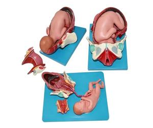 Modèle Anatomique De Laccouchement, Kit De Démonstration De Laccouchement Pelvien, Modèle En Pvc En 3 Étapes Représentant Le Bassin Maternel Et Le Fœtus, Avec Cordon Ombilical Amovible, Pour La