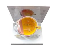 Modèle anatomique de l'œil humain réaliste et pathologique pour la recherche, l'utilisation pédagogique et la démonstration clinique, consultation de patients