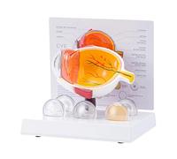 Modèle anatomique de l'œil humain réaliste pathologique pour la recherche, l'utilisation pédagogique et la démonstration clinique œil humain