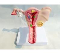 Modèle anatomique de l'utérus humain et de l'ovaire, modèle d'enseignement de l'anatomie vaginale du système reproducteur féminin, aides pédagogiques à l'anatomie de l'ovaire en gynécologie